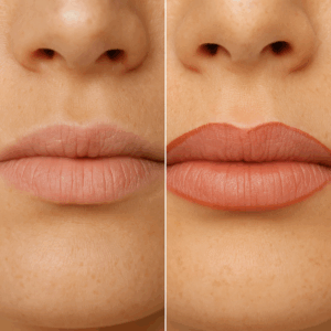immagine-di-prima-e-dopo-la-dermopigmentazione-contorno-labbra-centro-estetico-a-verona